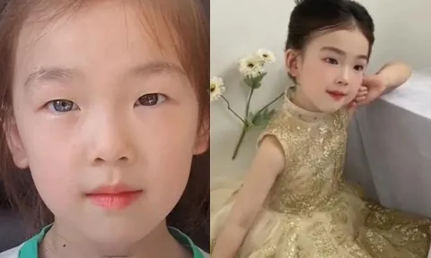 Bé gái 6 tuổi nổi tiếng sau một đêm vì có đôi mắt “kỳ lạ”, gia đình bật khóc khi nghe bác sĩ kết luận