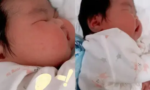 Bé sơ sinh chào đời như “người khổng lồ”, nặng 11kg, hai má phúng phính bánh bao khiến cả bệnh viện xôn xao