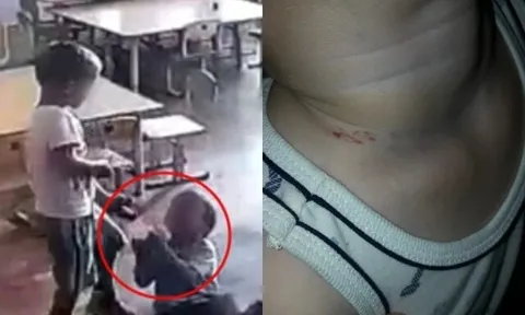 Đón con đi học về thì phát hiện trên cổ bé có vết bầm, kiểm tra camera mẹ Nga bủn rủn với cảnh tượng giữa lớp