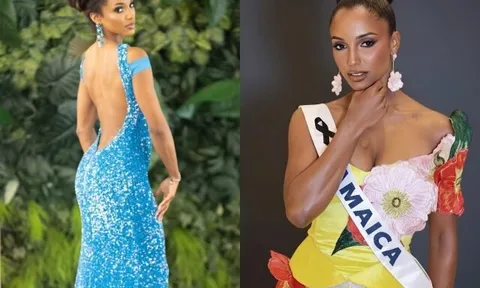 Đối thủ của Hương Giang trượt ngã trên sân khấu Miss Universe, phải rời đi bằng cáng: Tình trạng hiện tại thế nào? 
