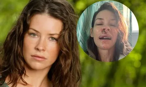 Ngất xỉu trên biển, nữ diễn viên rách mặt, chấn thương não