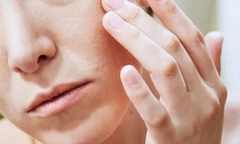 Làm sao để giảm khô ngứa da vào mùa lạnh?