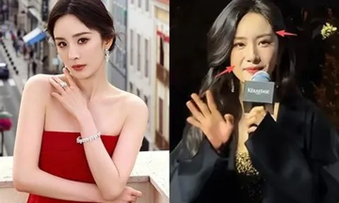 Diễn viên Dương Mịch tuổi 40 lộ gương mặt sưng phù khác lạ