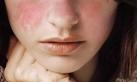 Để da không bị khô, sần sùi mùa lạnh