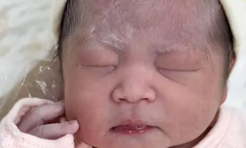 Con sinh 3 ngày vẫn không chịu mở mắt, nhận kết quả khám của bác sĩ bố mẹ mới biết do di truyền