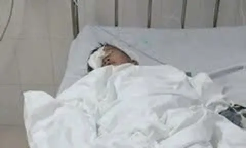 Xác minh vụ phụ huynh tố con học lớp 1 bị bạn chọc trúng mắt