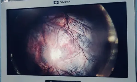 Giữ lại thiên chức làm mẹ cho bệnh nhân 22 tuổi