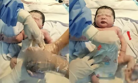 Bé sơ sinh chào đời bị bác sĩ và y tá liên tục tác động ngay trên bàn mổ, người mẹ rối rít cảm ơn
