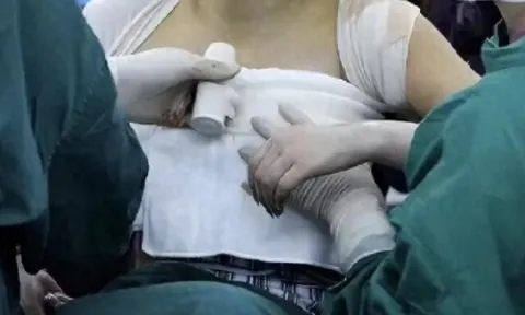 Mẹ phát hiện trên áo ngực con gái 13 tuổi thường xuyên dính màu lạ, đưa đi khám nghe bác sĩ nói mà run rẩy