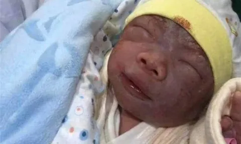 Mẹ muốn khóc khi con sơ sinh chào đời tím tái như “củ khoai môn”, 3 tháng sau “lột xác” xinh như búp bê