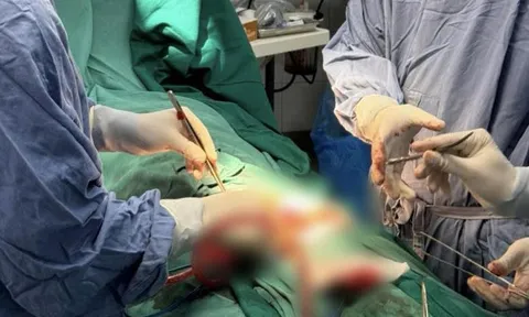 Người đàn ông nhập viện sau khi tự cắt bộ phận sinh dục