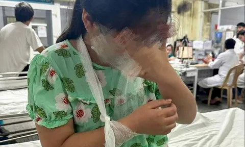 Học sinh lớp 4 bị cô giáo đánh phải vào bệnh viện