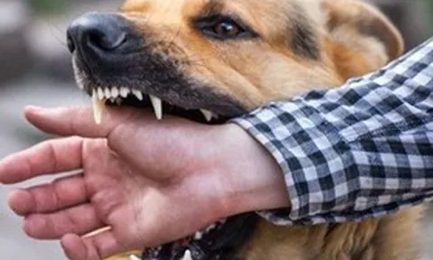 Người đàn ông 63 tuổi tử vong sau khi bị chó cắn lúc tập thể dục