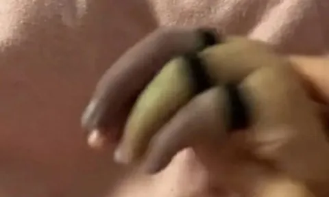 Con ngồi chơi ở phòng khách bỗng khóc rống lên, mẹ phát hoảng thấy tay con 3 màu, bác sĩ cảnh báo