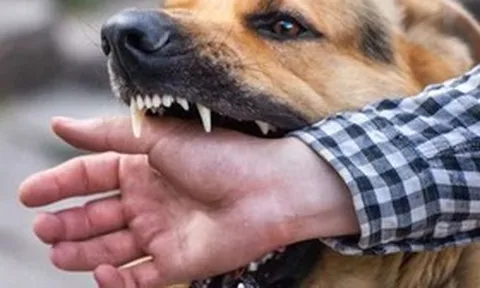 Sự cố thương tâm: Cụ ông 83 tuổi tử vong do chó nuôi trong nhà tấn công