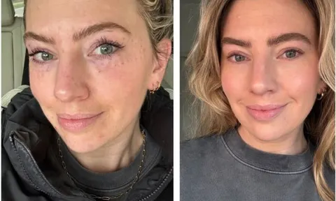 Cơn sốt trẻ hóa từ chiết xuất tinh dịch cá hồi 'làm mưa làm gió' thị trường thẩm mỹ