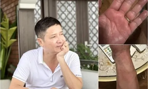 NSƯT Chí Trung mắc bệnh lạ, mất ngủ triền miên