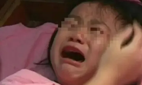 Con gái liên tục kêu "Đau mông quá!", mẹ đưa đi khám thì bác sĩ nói "Sao không đến sớm"