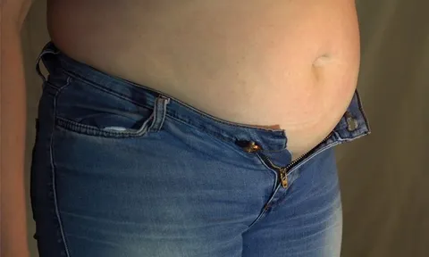Bụng to như mang thai, người phụ nữ 21 tuổi sốc khi phát hiện thứ "đáng sợ" trong bụng