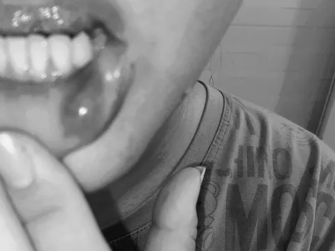 Thầy giáo đánh vợ phải nhập viện cấp cứu