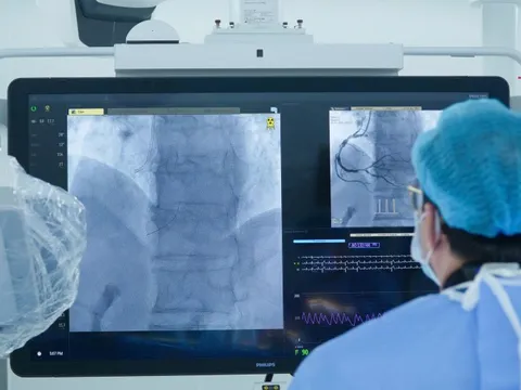 Nhồi máu cơ tim cấp mà tưởng đau ngực bình thường