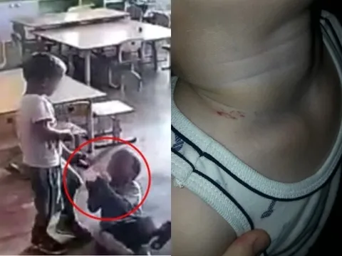 Đón con đi học về thì phát hiện trên cổ bé có vết bầm, kiểm tra camera mẹ Nga bủn rủn với cảnh tượng giữa lớp