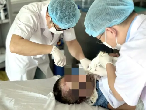 Giữ thang giúp hàng xóm, người đàn ông nhập viện với 30% cơ thể bỏng rộp