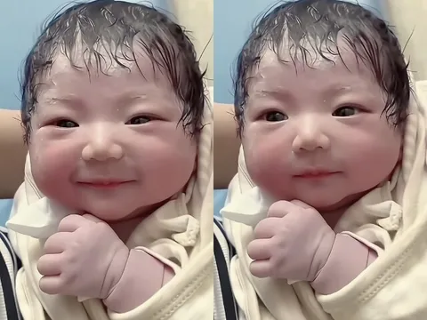 Bé sơ sinh chào đời đẹp như nữ thần, y tá đỡ đẻ vừa nhìn đã thốt lên: “Bé đã phẫu thuật thẩm mỹ thành công”