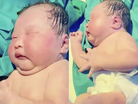 Bé sơ sinh chào đời nặng 9kg, cổ mất hút, bác sĩ đỡ đẻ lắc đầu: “Đứa bé này như trẻ 1 tuổi”