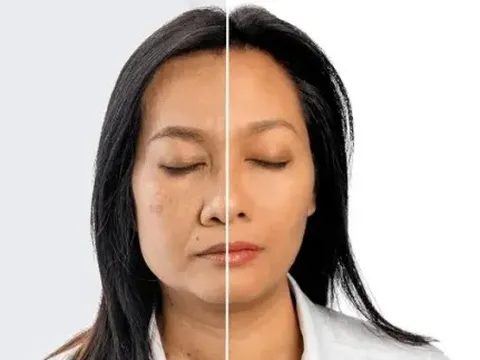 6 thói quen tưởng như vô hại khiến bạn già nhanh hơn