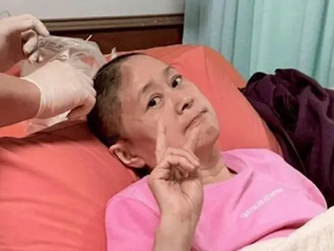 Diễn viên Vương Nguyệt 'Vườn sao băng' ngã chấn thương, mất một phần hộp sọ