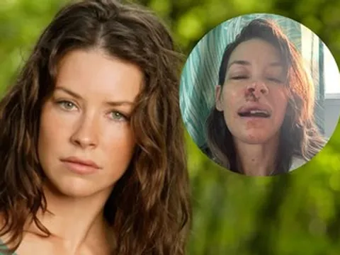 Ngất xỉu trên biển, nữ diễn viên rách mặt, chấn thương não