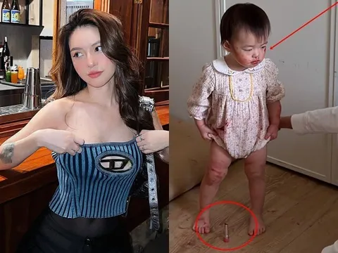 Hốt hoảng khi 2 con gái mặt mũi, chân tay đỏ choe choét, biết lý do, mẹ Việt tức giận