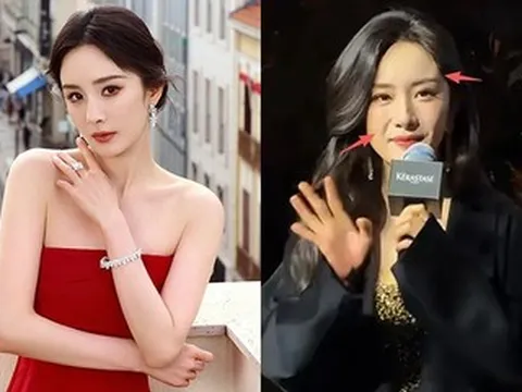 Diễn viên Dương Mịch tuổi 40 lộ gương mặt sưng phù khác lạ