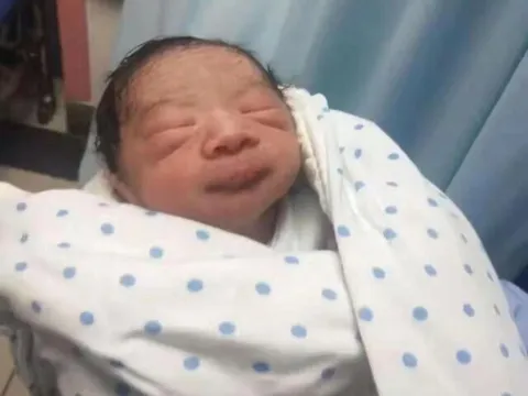 Bé sơ sinh chào đời da nhăn nheo như “khỉ con”, nửa năm sau bố mẹ kinh ngạc không nhận ra đứa trẻ ngày nào