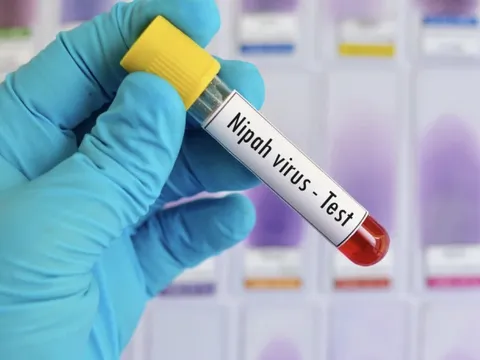 TPHCM tăng cường giám sát nhập cảnh, kiểm soát dịch bệnh Nipah