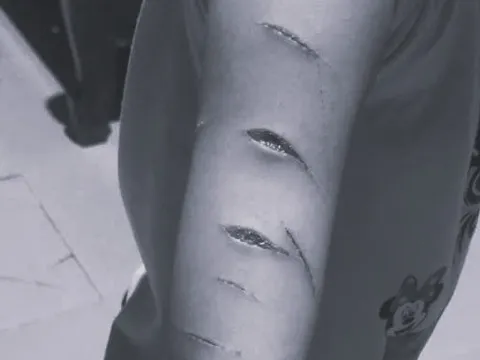 Học sinh bị chị họ dùng dao rạch nát tay, cô giáo vội báo gia đình