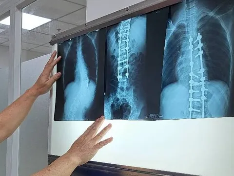 Bộ Y tế đề nghị không lấy thời gian chụp X-quang để từ chối BHYT