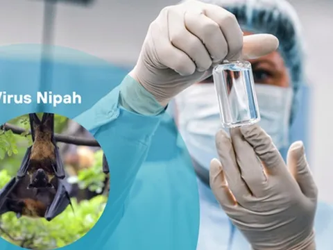 Bộ Y tế ban hành hướng dẫn chẩn đoán và điều trị bệnh do virus Nipah