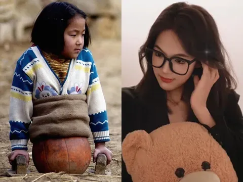 Bé gái 4 tuổi bị tai nạn gây xót xa toàn thế giới, diện mạo hiện tại xinh chuẩn mỹ nhân