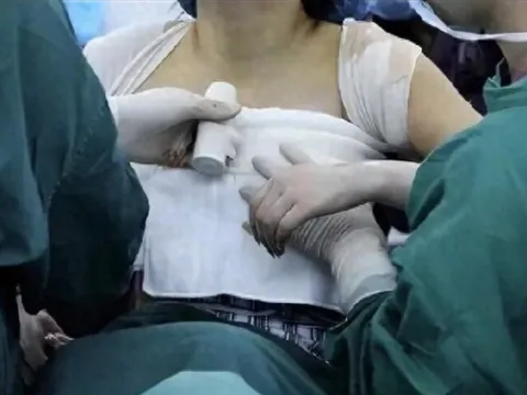 Mẹ phát hiện trên áo ngực con gái 13 tuổi thường xuyên dính màu lạ, đưa đi khám nghe bác sĩ nói mà run rẩy