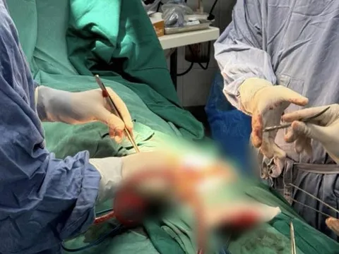 Người đàn ông nhập viện sau khi tự cắt bộ phận sinh dục