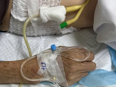 Cụ ông nhiều ngày bí tiểu, nước tiểu trắng đục như sữa