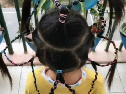 Con gái đi học về mỗi ngày một kiểu tóc nhưng liên tục nói đau đầu, mẹ nhắn tin cho cô giáo thì sốc trước câu trả lời