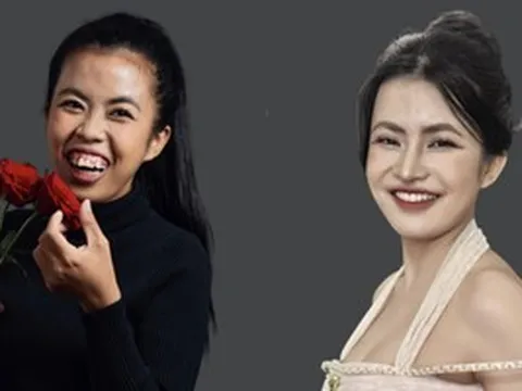 Khi ngoại hình trở thành "rào cản vô hình" của người trẻ