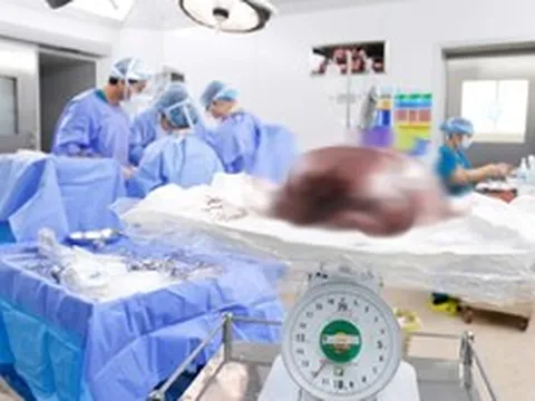 Phát hiện "thứ đáng sợ" gần 12kg trong tử cung của cô gái 25 tuổi