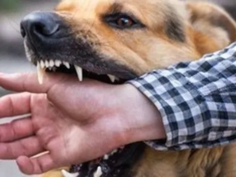 Người đàn ông 63 tuổi tử vong sau khi bị chó cắn lúc tập thể dục