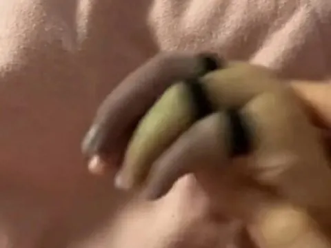 Con ngồi chơi ở phòng khách bỗng khóc rống lên, mẹ phát hoảng thấy tay con 3 màu, bác sĩ cảnh báo