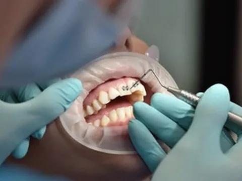 Mỗi hàm răng một phác đồ riêng nhờ nha khoa cá nhân hóa