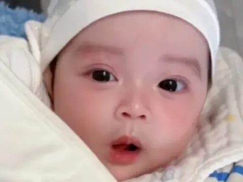 Bé sơ sinh chào đời toàn thân phủ màu trắng, 3 ngày sau nổi tiếng cả bệnh viện vì xinh như thiên thần